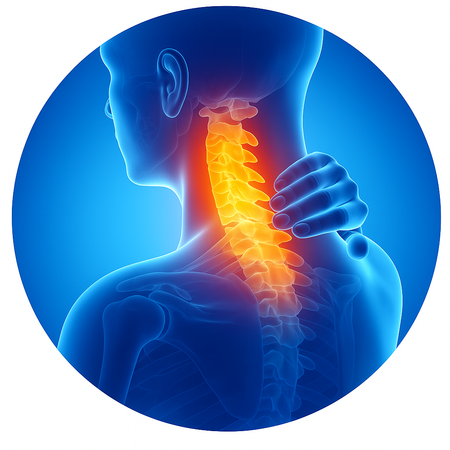 Dolor de cuello